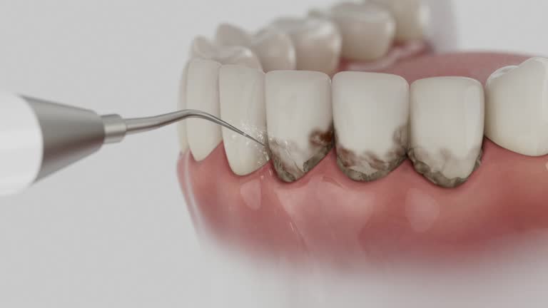 Reliable Dental Implants contractor in Wapato, WA by Smile Center Dentistry